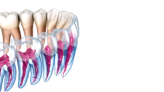 endodontie