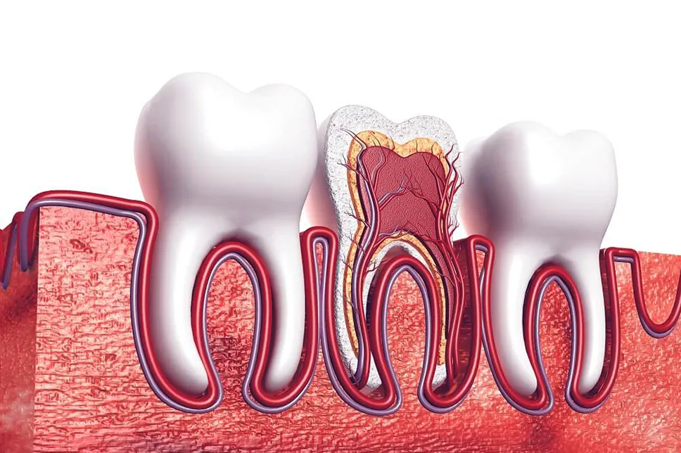Cauze si simptome endodontie