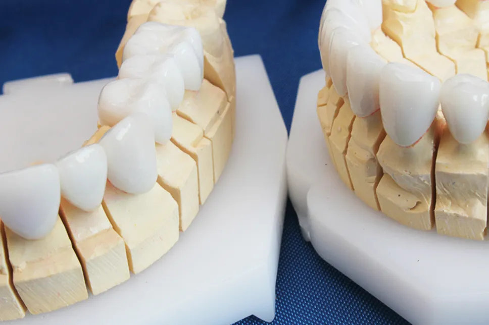 Dinți de zirconiu